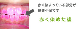 赤く染めた後