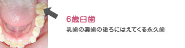 6歳臼歯